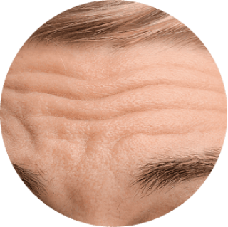 Deep Wrinkles